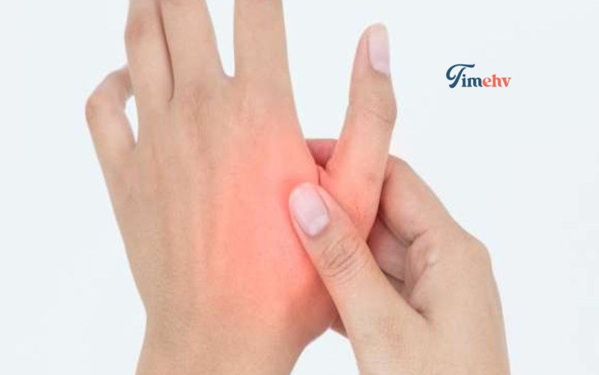 Kapselriss Finger – Ursachen, Symptome und Behandlung